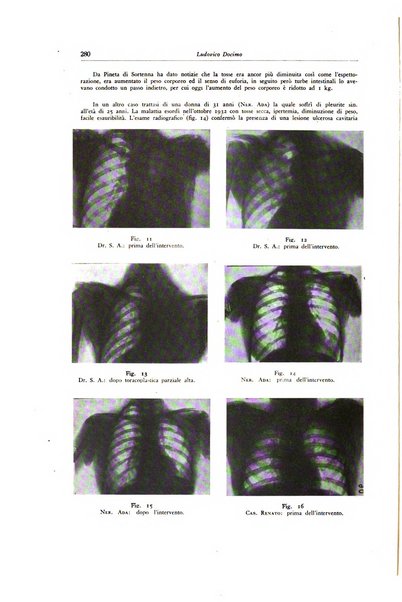 Lotta contro la tubercolosi rivista mensile