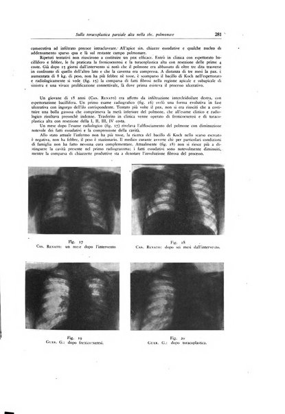 Lotta contro la tubercolosi rivista mensile