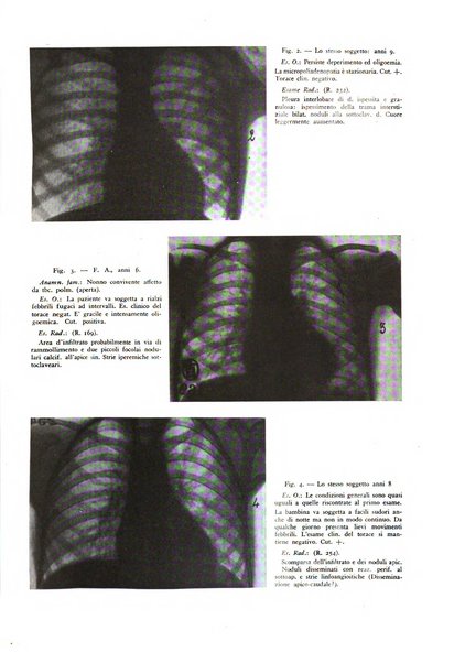 Lotta contro la tubercolosi rivista mensile