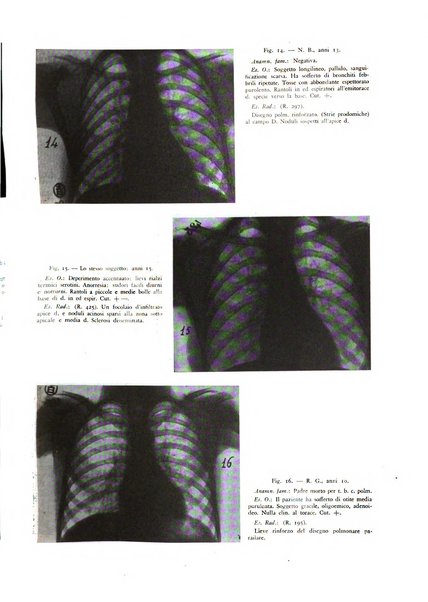 Lotta contro la tubercolosi rivista mensile