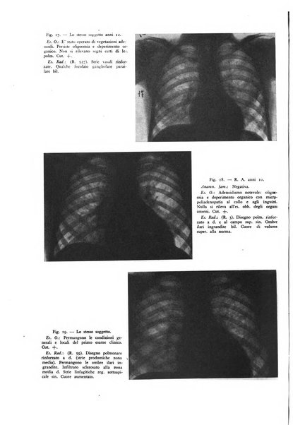 Lotta contro la tubercolosi rivista mensile