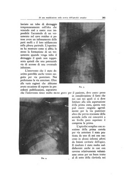 Lotta contro la tubercolosi rivista mensile