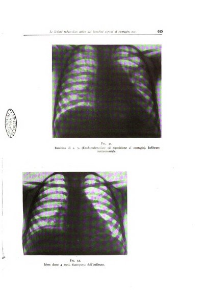 Lotta contro la tubercolosi rivista mensile