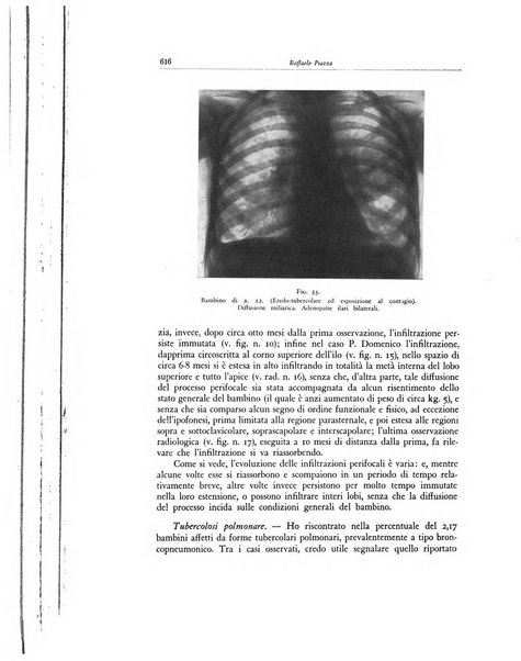 Lotta contro la tubercolosi rivista mensile