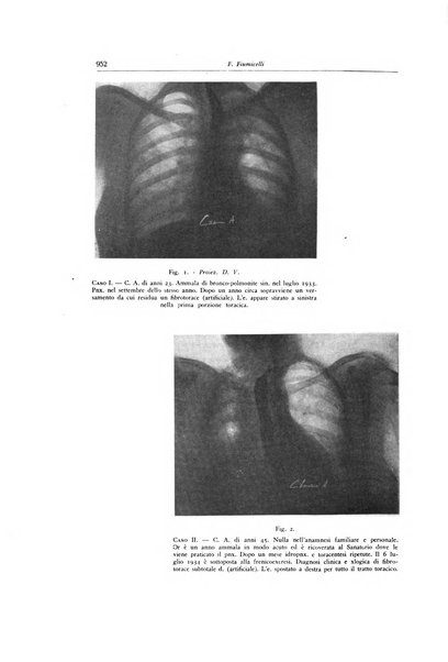 Lotta contro la tubercolosi rivista mensile