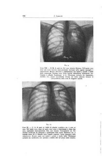 Lotta contro la tubercolosi rivista mensile