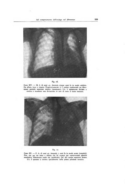 Lotta contro la tubercolosi rivista mensile