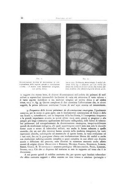 Lotta contro la tubercolosi rivista mensile