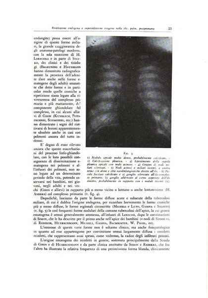 Lotta contro la tubercolosi rivista mensile