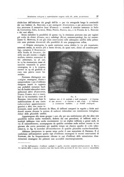 Lotta contro la tubercolosi rivista mensile