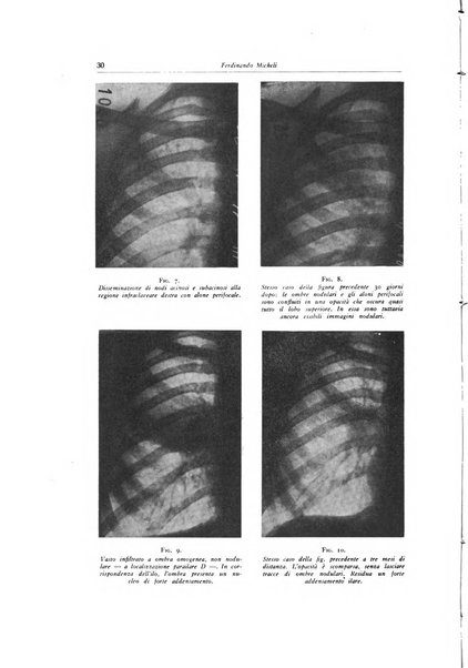 Lotta contro la tubercolosi rivista mensile