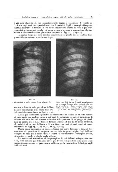 Lotta contro la tubercolosi rivista mensile