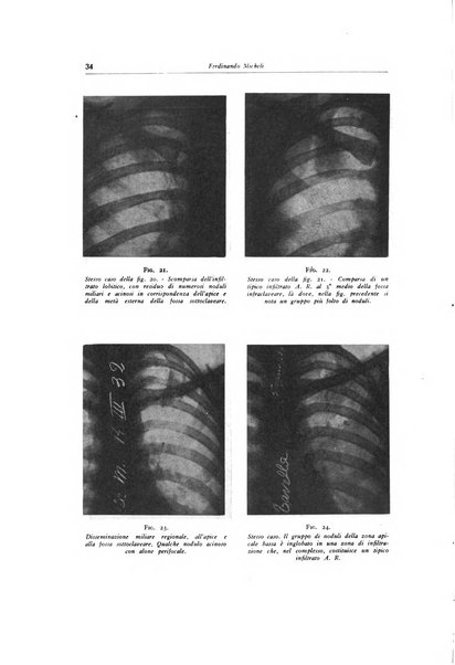 Lotta contro la tubercolosi rivista mensile