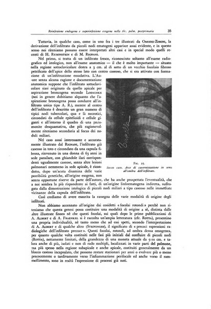 Lotta contro la tubercolosi rivista mensile