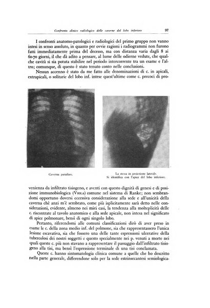 Lotta contro la tubercolosi rivista mensile