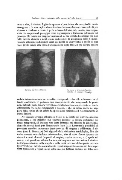 Lotta contro la tubercolosi rivista mensile