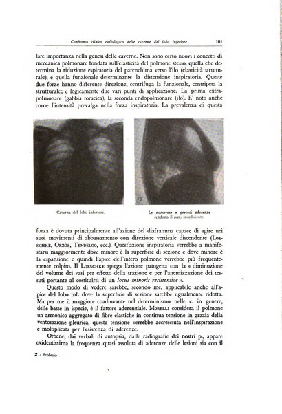 Lotta contro la tubercolosi rivista mensile