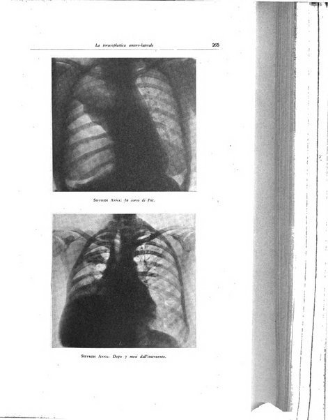 Lotta contro la tubercolosi rivista mensile