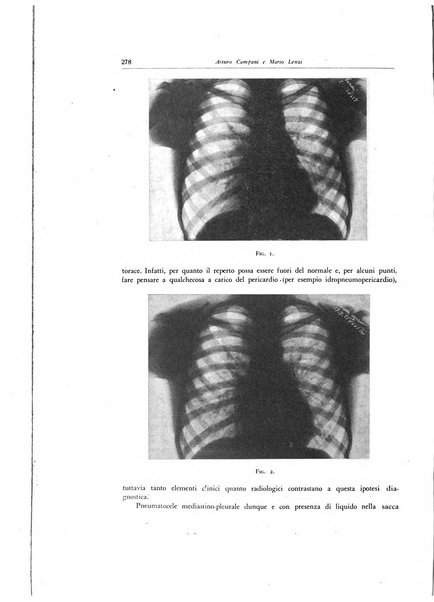 Lotta contro la tubercolosi rivista mensile