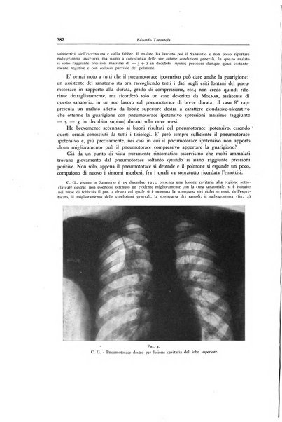 Lotta contro la tubercolosi rivista mensile