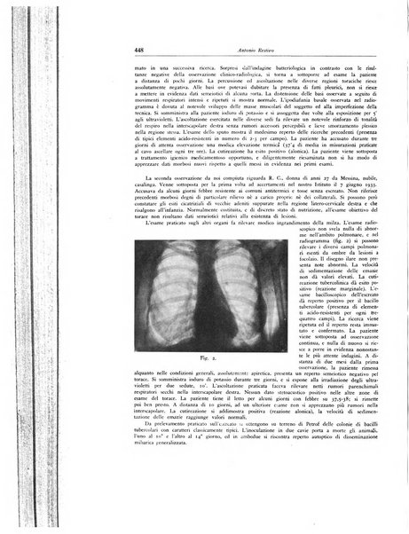 Lotta contro la tubercolosi rivista mensile