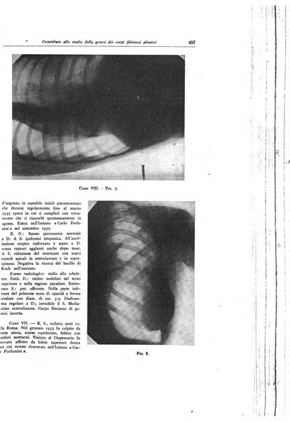 Lotta contro la tubercolosi rivista mensile