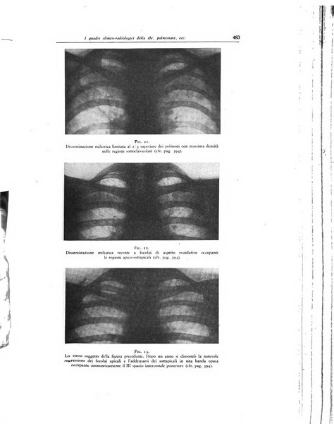 Lotta contro la tubercolosi rivista mensile