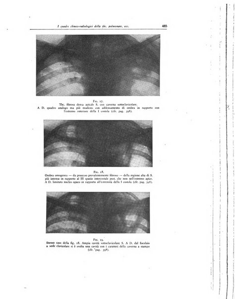 Lotta contro la tubercolosi rivista mensile