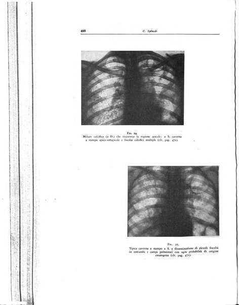 Lotta contro la tubercolosi rivista mensile