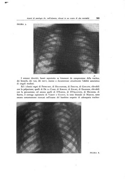 Lotta contro la tubercolosi rivista mensile