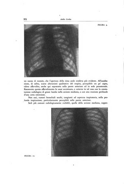 Lotta contro la tubercolosi rivista mensile