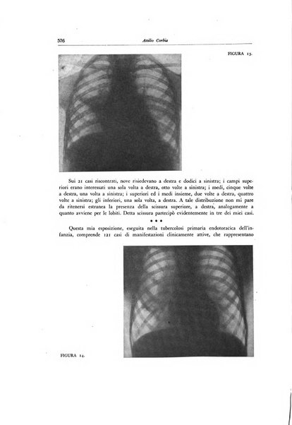 Lotta contro la tubercolosi rivista mensile