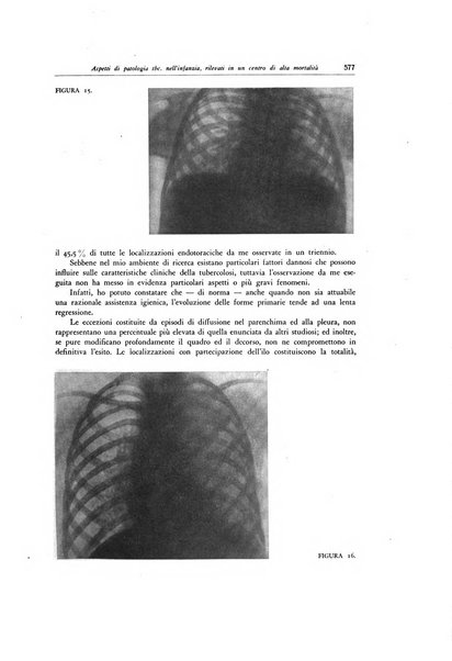 Lotta contro la tubercolosi rivista mensile