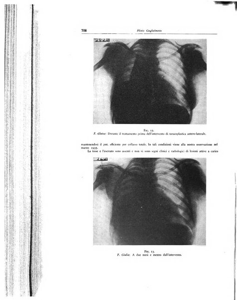 Lotta contro la tubercolosi rivista mensile