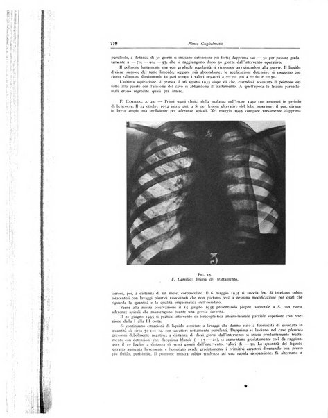 Lotta contro la tubercolosi rivista mensile