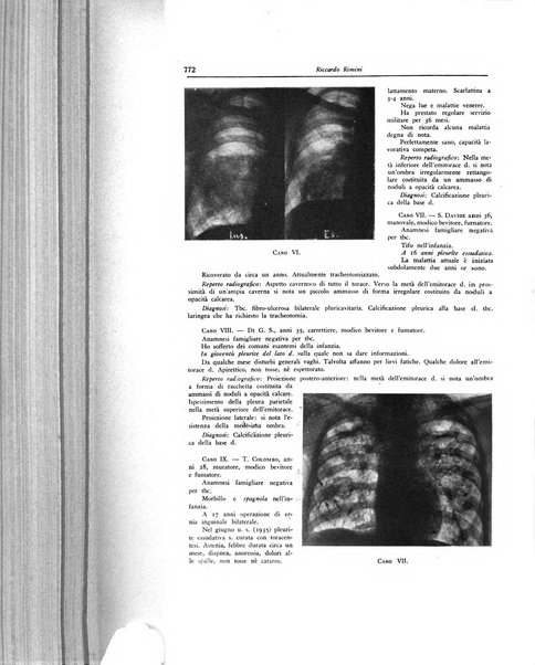 Lotta contro la tubercolosi rivista mensile