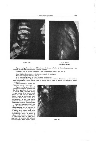 Lotta contro la tubercolosi rivista mensile