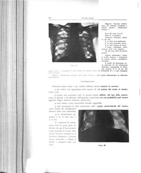 Lotta contro la tubercolosi rivista mensile