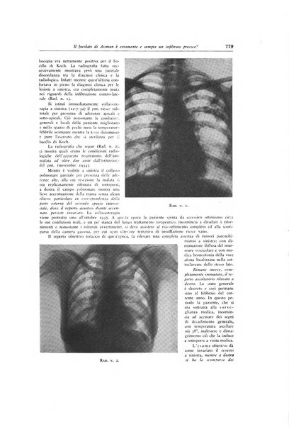 Lotta contro la tubercolosi rivista mensile