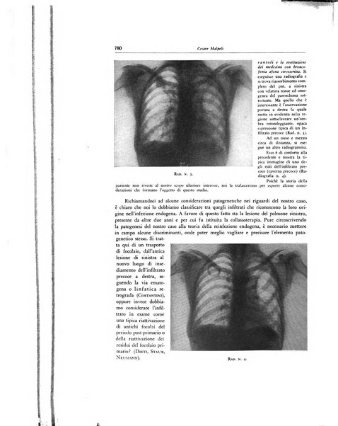 Lotta contro la tubercolosi rivista mensile