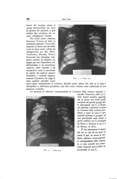 Lotta contro la tubercolosi rivista mensile