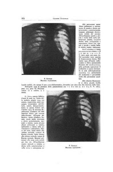 Lotta contro la tubercolosi rivista mensile