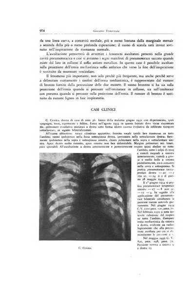 Lotta contro la tubercolosi rivista mensile