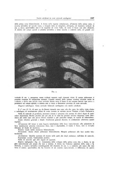 Lotta contro la tubercolosi rivista mensile