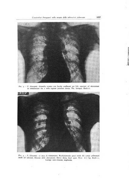 Lotta contro la tubercolosi rivista mensile