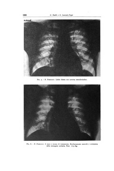 Lotta contro la tubercolosi rivista mensile