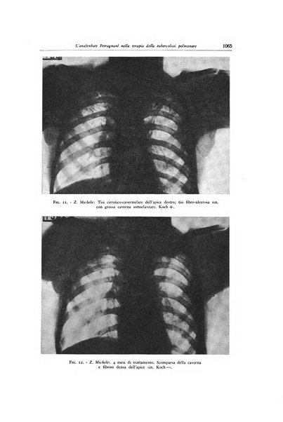 Lotta contro la tubercolosi rivista mensile