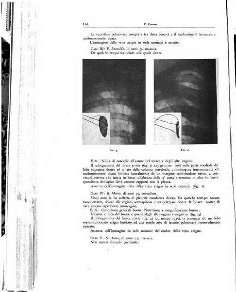 Lotta contro la tubercolosi rivista mensile