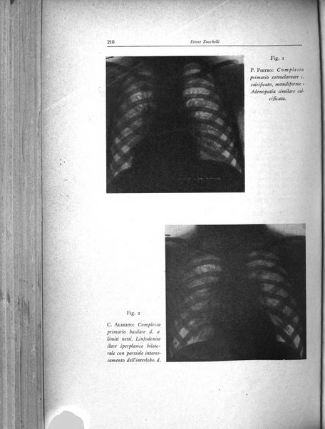 Lotta contro la tubercolosi rivista mensile