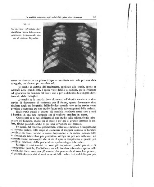 Lotta contro la tubercolosi rivista mensile